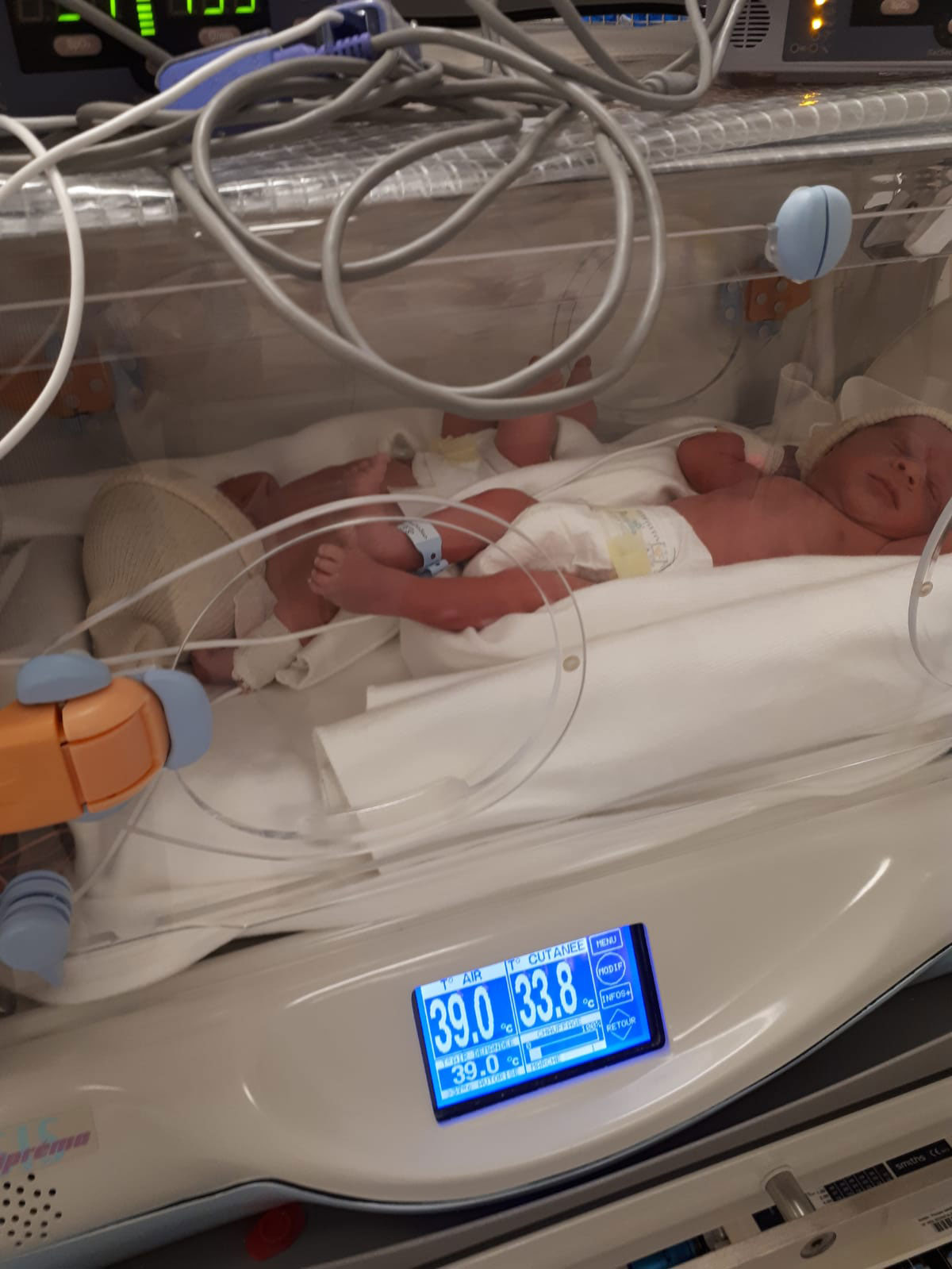 Newborn baby in the infant incubator